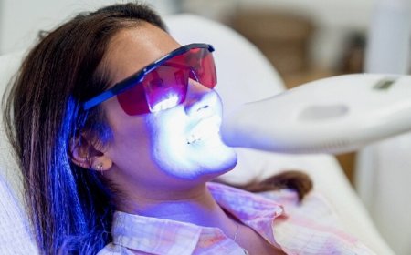 Dazzling Smile Secrets: Brighten Your Teeth Fast