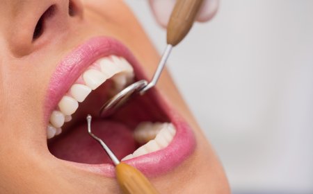 Brighten Your Smile: A Complete Guide to Teeth Cleaning in Dubai